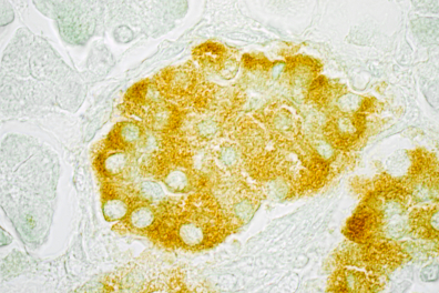 Cellules sécrétrices d'insuline - Ilôt de Langerhans du Pancréas (traitement histochimique) x100